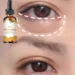 Top Hydrating Eye Oil for Reducing Dark Circles and Puffiness Naturally