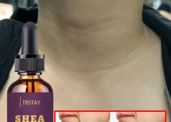 Discover the Best Neck Treatment for Youthful Skin and Deep Line Reduction