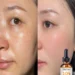 Discover the Best Hydrating Facial Oil for Sensitive Skin and Radiant Glow